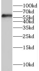 SMPD1 antibody|SMPD1抗体