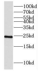 DUS4L antibody|DUS4L抗体