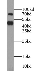 TRIM5 antibody|TRIM5抗体