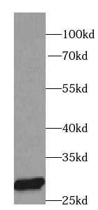 PRDX3 antibody|PRDX3抗体 FNab068