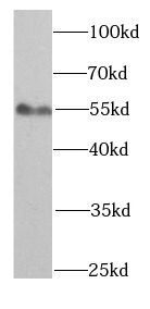 SMAD1 antibody|SMAD1抗体