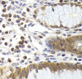 CDK6 antibody|CDK6抗体 FNab01562