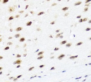 PTEN antibody|PTEN抗体 FNab09821