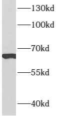 ARMCX2 antibody|ARMCX2抗体