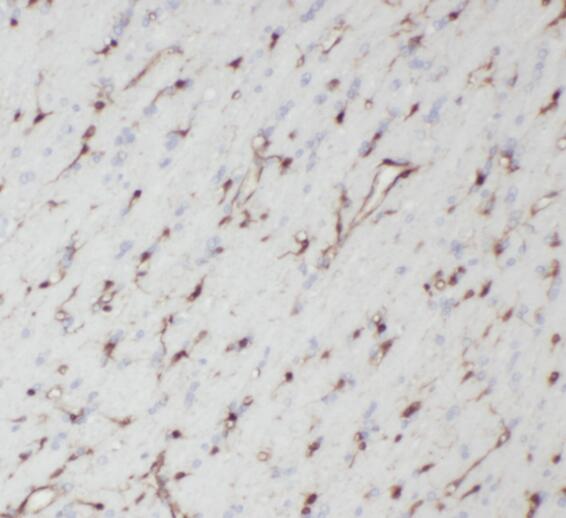 TPPP antibody|TPPP抗体 FNab08898