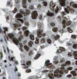 BANP antibody|BANP抗体