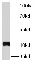 TMEM59 antibody|TMEM59抗体