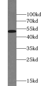 ZNF256 antibody|ZNF256抗体