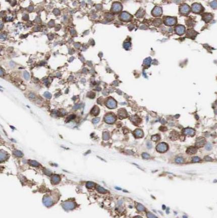 CEP350-Specific antibody|CEP35