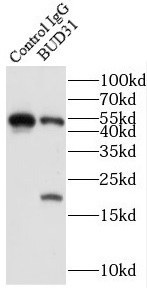 ATAD1 antibody|ATAD1抗体
