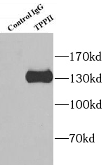 TDG antibody|TDG抗体