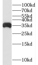 SUCLG1 antibody|SUCLG1抗体