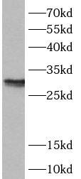 ANP32B antibody|ANP32B抗体 FNab0