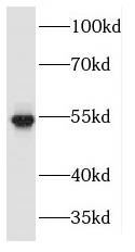 MAPKAPK5 antibody|MAPKAPK5抗体