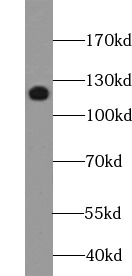 MUC1 antibody|MUC1抗体 FNab05427