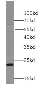 RTN1-C antibody|RTN1-C抗体