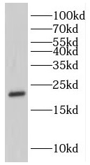 GKN1 antibody|GKN1抗体 FNab03357