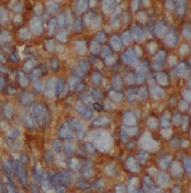 HSPA1A antibody|HSPA1A抗体 FNab0