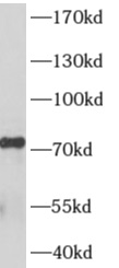 AKAP8L antibody|AKAP8L抗体