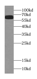 MAP3K2 antibody|MAP3K2抗体