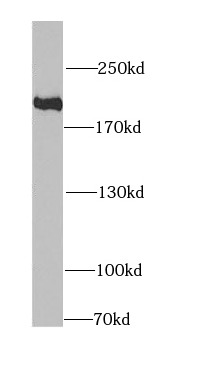 KIF1B antibody|KIF1B抗体