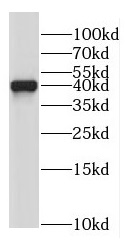 NDEL1 antibody|NDEL1抗体