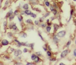ISG15 antibody|ISG15抗体