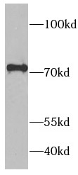 RAF1 antibody|RAF1抗体 FNab07087