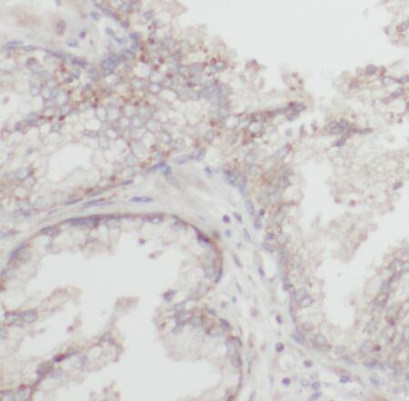 RBBP9 antibody|RBBP9抗体 FNab071