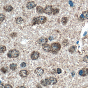 FOXO6 antibody|FOXO6抗体 FNab032