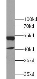 NR1H2 antibody|NR1H2抗体