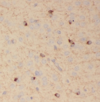 SV2B antibody|SV2B抗体