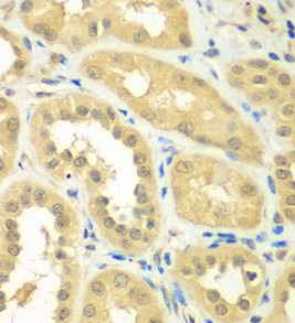 RPS6KL1 antibody|RPS6KL1抗体