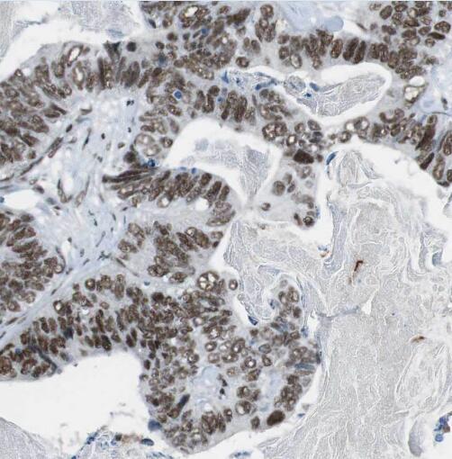 PCNA antibody|PCNA抗体 FNab06216