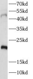 PTGER4 antibody|PTGER4抗体