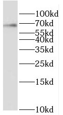 RBM42 antibody|RBM42抗体