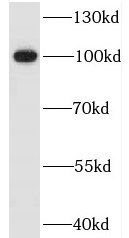 ITIH3 antibody|ITIH3抗体
