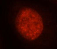 Histone H1.2 antibody|Histone 