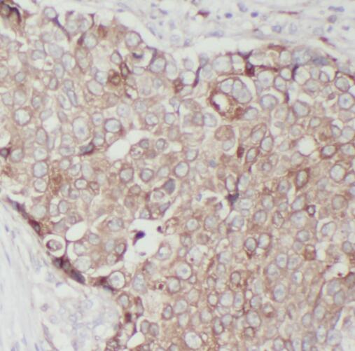 RPS16 antibody|RPS16抗体