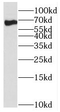 SF3A2 antibody|SF3A2抗体