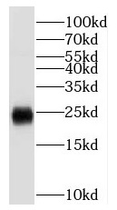SCN2B antibody|SCN2B抗体