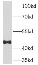 TEX13A antibody|TEX13A抗体