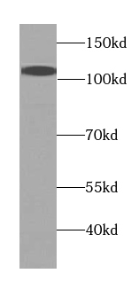USO1 antibody|USO1抗体