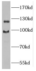 GUCY2D antibody|GUCY2D抗体