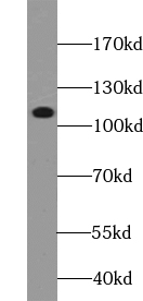 USP37 antibody|USP37抗体