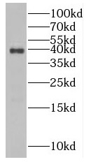 NUDT9 antibody|NUDT9抗体