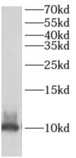 AKAP7 antibody|AKAP7抗体
