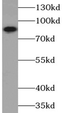 PIK3R1 antibody|PIK3R1抗体 FNab0