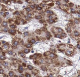 TNFRSF1A antibody|TNFRSF1A抗体 F