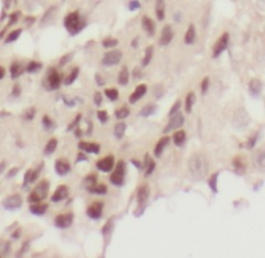 SUZ12 antibody|SUZ12抗体